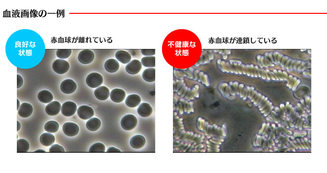 血液をサラサラにするサプリメント サプリメントの効果と病気 症状別の効用